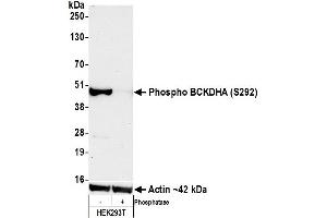 Western Blotting (WB) image for anti-Branched Chain Keto Acid Dehydrogenase E1, alpha Polypeptide (BCKDHA) (pSer292) antibody (ABIN7449282) (Recombinant BCKDHA 抗体  (pSer292))