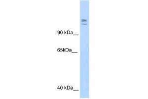 WB Suggested Anti-MYBBP1A Antibody Titration:  1. (MYBBP1A 抗体  (C-Term))