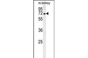 GNE Antibody (C-term) (ABIN651511 and ABIN2840271) western blot analysis in mouse kidney tissue lysates (35 μg/lane). (GNE 抗体  (C-Term))
