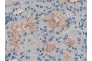DAB staining on IHC-P; Samples: Human Kidney Tissue (HSPH1 抗体  (AA 595-733))