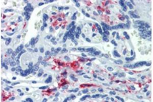 Placenta, Human: Formalin-Fixed, Paraffin-Embedded (FFPE) (CD163 抗体)