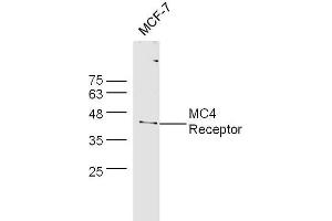 MCF-7 cell lysates probed with Rabbit Anti-MC4 Receptor Polyclonal Antibody, Unconjugated  at 1:500 for 90 min at 37˚C. (MC4R 抗体  (AA 1-50))