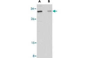 Western blot analysis of GRTP1 in SK-N-SH cell lysate with GRTP1 polyclonal antibody  at 1 ug/mL in the (A) absence and (B) presence of blocking peptide. (GRTP1 抗体  (Internal Region))