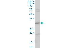 Western Blotting (WB) image for anti-Centromere Protein H (CENPH) (AA 1-247) antibody (ABIN528745)