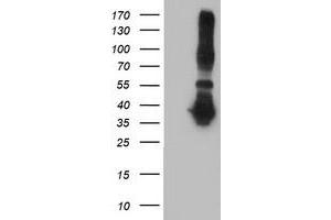 Western Blotting (WB) image for anti-Ankyrin Repeat Domain 53 (ANKRD53) (AA 1-300) antibody (ABIN1490719) (ANKRD53 抗体  (AA 1-300))