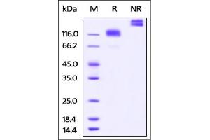 SDS-PAGE (SDS) image for Colony Stimulating Factor 1 Receptor (CSF1R) (AA 99-596) protein (Fc Tag) (ABIN5526647)