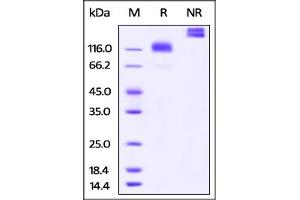 Cynomolgus M-CSF R, Fc Tag on  under reducing (R) and ing (NR) conditions. (CSF1R Protein (AA 99-596) (Fc Tag))