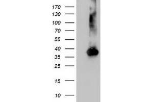 Western Blotting (WB) image for anti-Nudix (Nucleoside Diphosphate Linked Moiety X)-Type Motif 18 (NUDT18) antibody (ABIN1499861) (NUDT18 抗体)