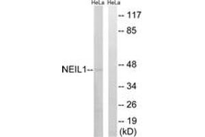 Western blot analysis of extracts from HeLa cells, using NEIL1 Antibody. (NEIL1 抗体  (AA 291-340))