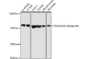 Western Blotting (WB) image for anti-Solute Carrier Family 6 (Neurotransmitter Transporter, serotonin), Member 4 (SLC6A4) (C-Term) antibody (ABIN7270477)