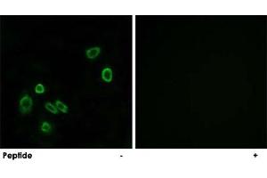 Immunofluorescence analysis of A-549 cells, using BRP44L polyclonal antibody . (BRP44L 抗体  (Internal Region))