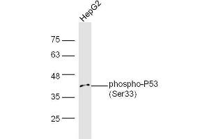 Western Blotting (WB) image for anti-Tumor Protein P53 (TP53) (pSer33) antibody (ABIN702925)