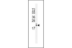 R Antibody (Center) (ABIN654772 and ABIN2844451) western blot analysis in CHO cell line lysates (35 μg/lane). (RNF185 抗体  (AA 88-117))