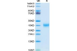 CLEC10A Protein (AA 57-304) (His tag)