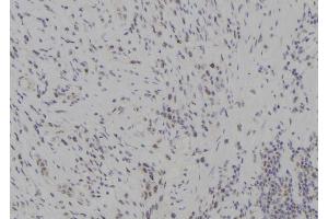 ABIN6277285 at 1/100 staining Human gastric tissue by IHC-P. (TBK1 抗体  (Internal Region))