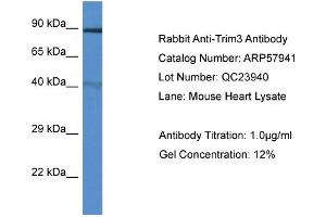 Western Blotting (WB) image for anti-Tripartite Motif Containing 3 (TRIM3) (N-Term) antibody (ABIN2787468)