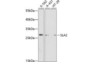 Western blot analysis of extracts of various cell lines, using SL antibody (ABIN6130692, ABIN6147825, ABIN6147826 and ABIN6216581) at 1:3000 dilution. (SLAP2 抗体  (AA 1-160))