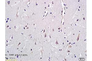 Formalin-fixed and paraffin embedded rat brain tissue labeled with Anti-CD203c Polyclonal Antibody, Unconjugated (ABIN731453) followed by conjugation to the secondary antibody and DAB staining (ENPP3 抗体  (AA 40-140))