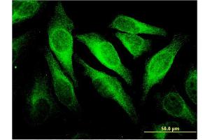 Immunofluorescence of monoclonal antibody to CEACAM6 on HeLa cell. (CEACAM6 抗体  (AA 156-265))