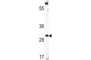 Western Blotting (WB) image for anti-Brain-Derived Neurotrophic Factor (BDNF) antibody (ABIN3003616) (BDNF 抗体)