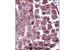 Immunohistochemistry (Formalin/PFA-fixed paraffin-embedded sections) of human skeletal muscle with RGS9 polyclonal antibody  followed by peroxidase conjugation of the secondary antibody and DAB staining. (RGS 抗体  (AA 149-178))