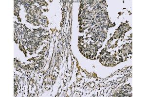 IHC analysis of Nac1/NACC1 using anti-Nac1/NACC1 antibody (ABIN7599756).