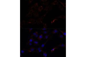 Immunofluorescence analysis of C6 cells using 43716 antibody (ABIN7265350) at dilution of 1:100. (Septin 8 抗体  (AA 348-427))