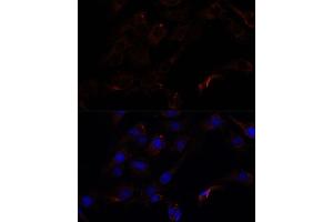 Immunofluorescence analysis of C6 cells using 43716 antibody (ABIN7265350) at dilution of 1:100. (Septin 8 抗体  (AA 348-427))