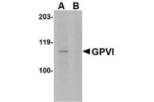 Western blot analysis of GPVI in A-20 lysate with AP30379PU-N GPVI antibody at 1μg/ml in either the absence or (B) the presence of blocking peptide. (GP6 抗体  (Center))
