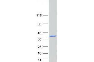 Western Blotting (WB) image for Calcyon Neuron-Specific Vesicular Protein (CALY) protein (Myc-DYKDDDDK Tag) (ABIN2713083)