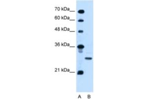 Western Blotting (WB) image for anti-Podoplanin (PDPN) antibody (ABIN2463964) (Podoplanin 抗体)