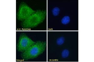 ABIN571180 Immunofluorescence analysis of paraformaldehyde fixed A549 cells, permeabilized with 0. (PLA2G4A 抗体  (Internal Region))