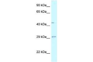 Western Blot showing FUT8 antibody used at a concentration of 1 ug/ml against Fetal Liver Lysate (FUT8 抗体  (N-Term))