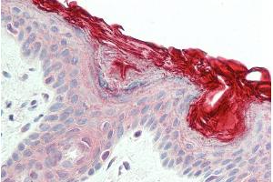 ABIN185623 (5µg/ml) staining of paraffin embedded Human Skin. (PERP 抗体  (C-Term))