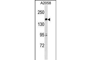 Western blot analysis in A2058 cell line lysates (35ug/lane). (ZBTB38 抗体  (N-Term))