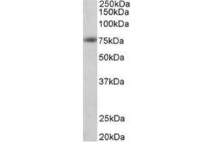AP31949PU-N APP antibody staining of Human Cerebral Cortex lysate at 1 µg/ml (35µg protein in RIPA buffer). (APP 抗体  (N-Term))