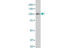 SREBF2 polyclonal antibody (A01), Lot # 051213JC01 Western Blot analysis of SREBF2 expression in IMR-32 . (SREBF2 抗体  (AA 801-900))