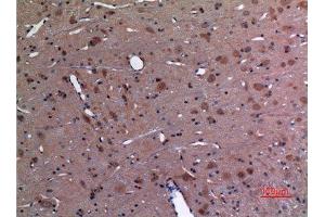 Immunohistochemistry (IHC) analysis of paraffin-embedded Rat Brain, antibody was diluted at 1:100. (UBE2A/B (C-Term) 抗体)