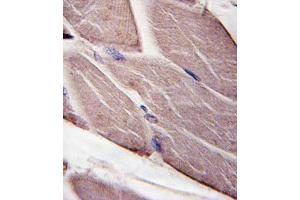 Formalin-fixed and paraffin-embedded human skeletal muscle tissue reacted with PDK4-, which was peroxidase-conjugated to the secondary antibody, followed by DAB staining. (PDK4 抗体  (AA 250-277))