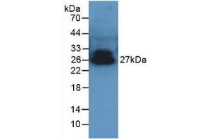 Detection of ADPN in Porcine Serum using Polyclonal Antibody to Adiponectin (ADPN) (ADIPOQ 抗体  (AA 17-243))