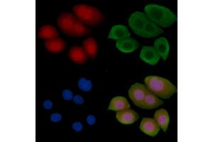 Phospho-ID2 (Thr27) Antibody staining Hela cells(45 min of heat-shock treatment) by IF/ICC. (Id2 抗体  (pThr27))