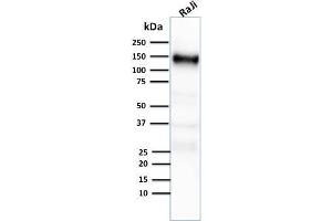 Western Blot Analysis of human Raji cell lysate using CD21-Monospecific Mouse Monoclonal Antibody (CR2/2754).
