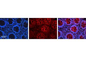 Rabbit Anti-CEBPB Antibody Catalog Number: ARP31259_P050 Formalin Fixed Paraffin Embedded Tissue: Human Appendix (Colon) Tissue Observed Staining: Cytoplasm Primary Antibody Concentration: 1:100 Other Working Concentrations: N/A Secondary Antibody: Donkey anti-Rabbit-Cy3 Secondary Antibody Concentration: 1:200 Magnification: 20X Exposure Time: 0. (CEBPB 抗体  (C-Term))