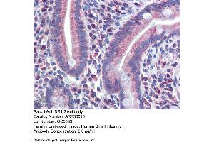 Immunohistochemistry (IHC) image for anti-Nuclear Receptor Subfamily 1, Group I, Member 2 (NR1I2) (N-Term) antibody (ABIN2774988)