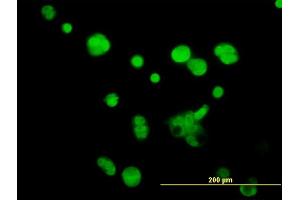 Immunofluorescence of monoclonal antibody to ATPIF1 on MCF-7 cell. (ATPase Inhibitory Factor 1 抗体  (AA 1-106))