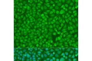 Immunofluorescence analysis of U2OS cells using CHEK1 Polyclonal Antibody at dilution of 1:100. (CHEK1 抗体)