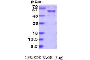SDS-PAGE (SDS) image for RAB3A Interacting Protein (Rabin3)-Like 1 (RAB3IL1) (AA 1-382) protein (His tag) (ABIN5854004) (RAB3IL1 Protein (AA 1-382) (His tag))