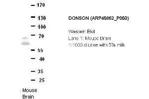 Image no. 2 for anti-Downstream Neighbor of SON (DONSON) (Middle Region) antibody (ABIN2782388) (DONSON 抗体  (Middle Region))
