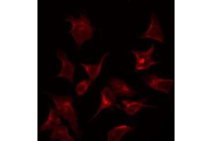 ABIN6267310 staining HeLa by IF/ICC. (PKC beta 抗体  (pSer661))