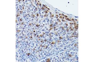 Immunohistochemistry of paraffin-embedded human tonsil using GPR109A/HM74A/HC Rabbit pAb (ABIN7267804) at dilution of 1:25 (40x lens). (HCAR2 抗体  (AA 250-350))